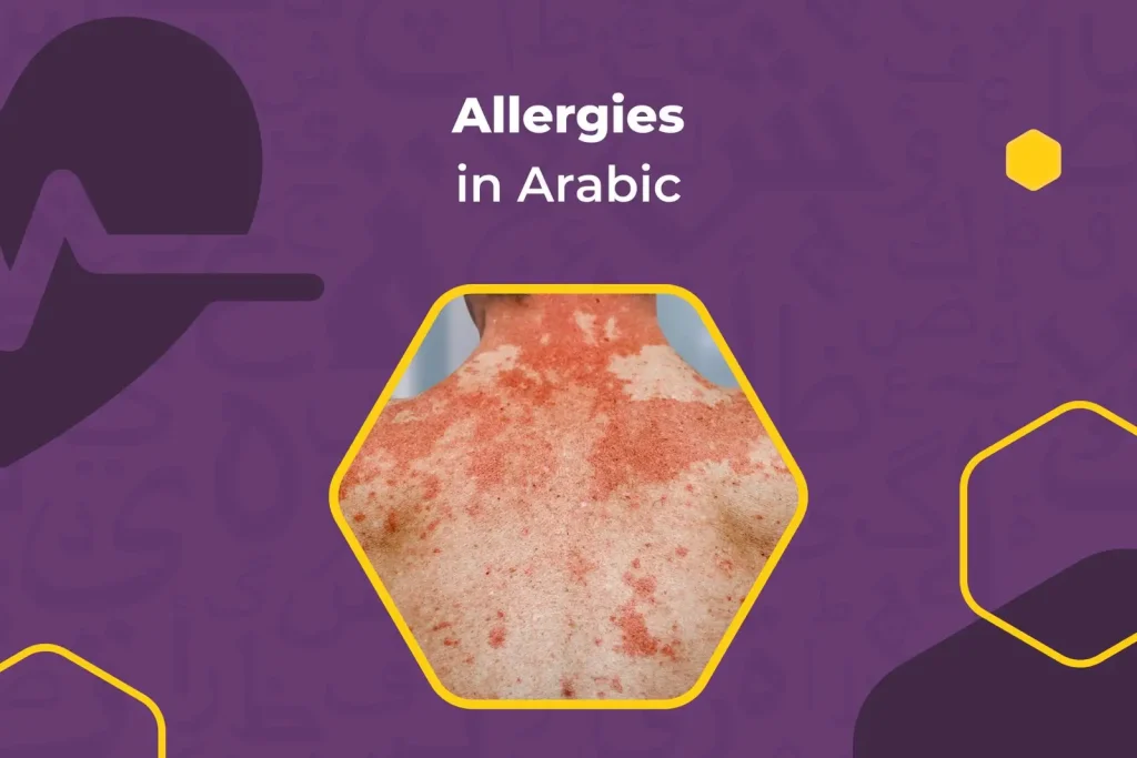 Allergies in Arabic
