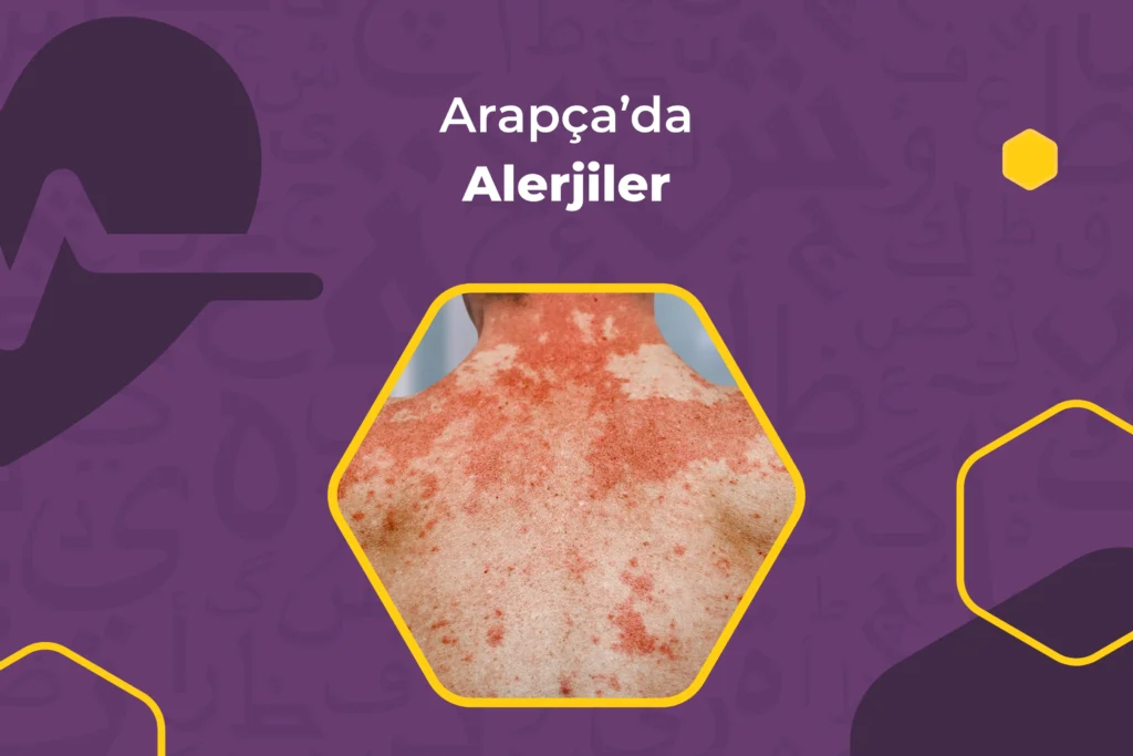 Arapçada Alerjiler